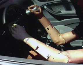 Picture - Person with artificial higher limbs driving a special car