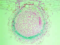 Image - Enlarged cells