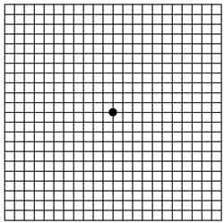 Image - Amsler grid