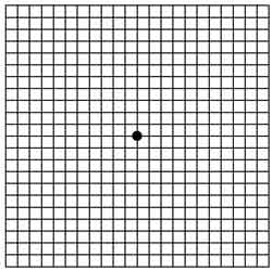 Image - Amsler grid